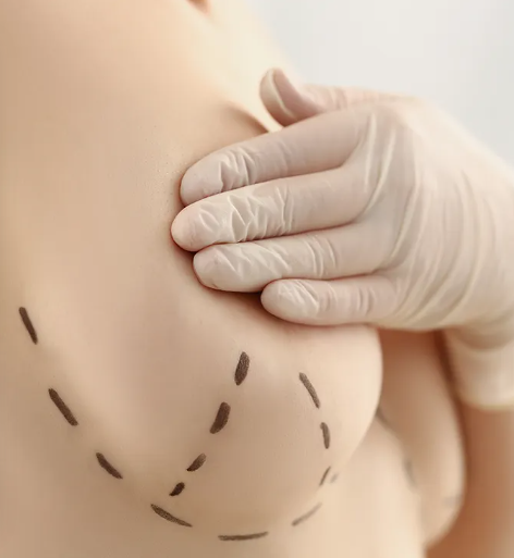 The Twirl Internal Bra Technique