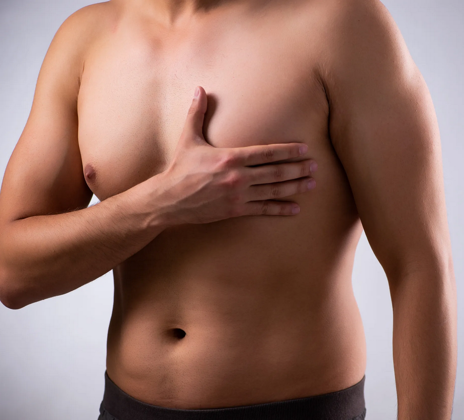 Gynecomastia