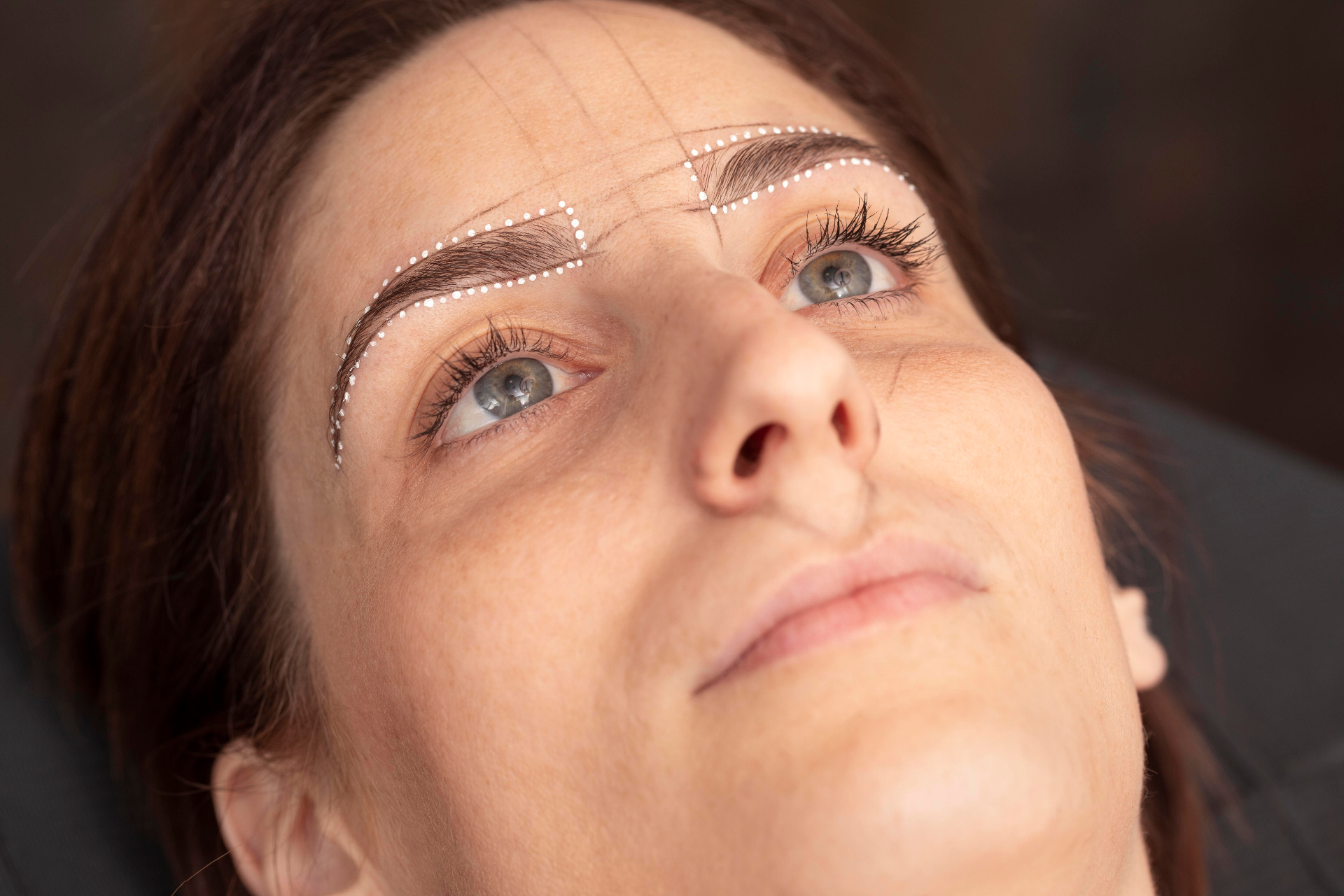 Transblepharoplasty Brow Lift with Endochor