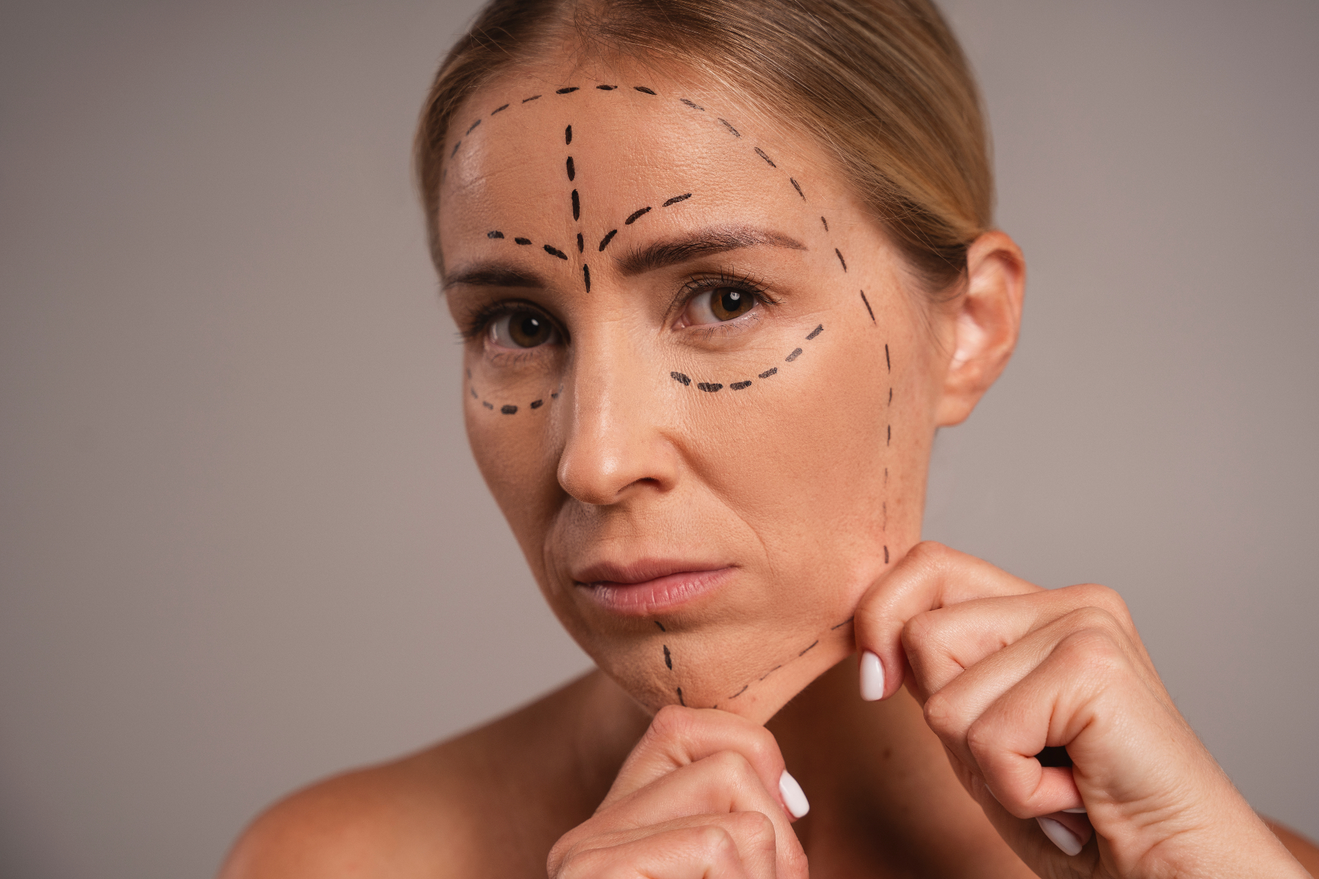 EndoChor Transblepharoplasty with Dr. Karaaltin