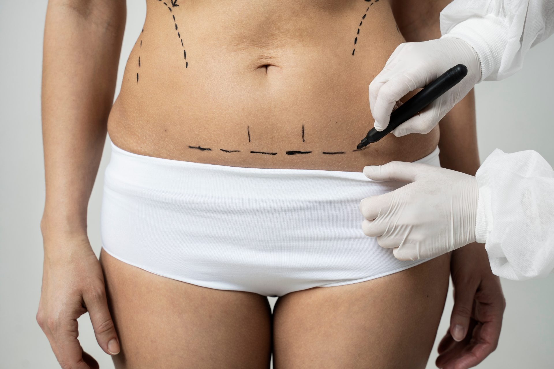 Rib Cage Molding With Dr. Karaaltin