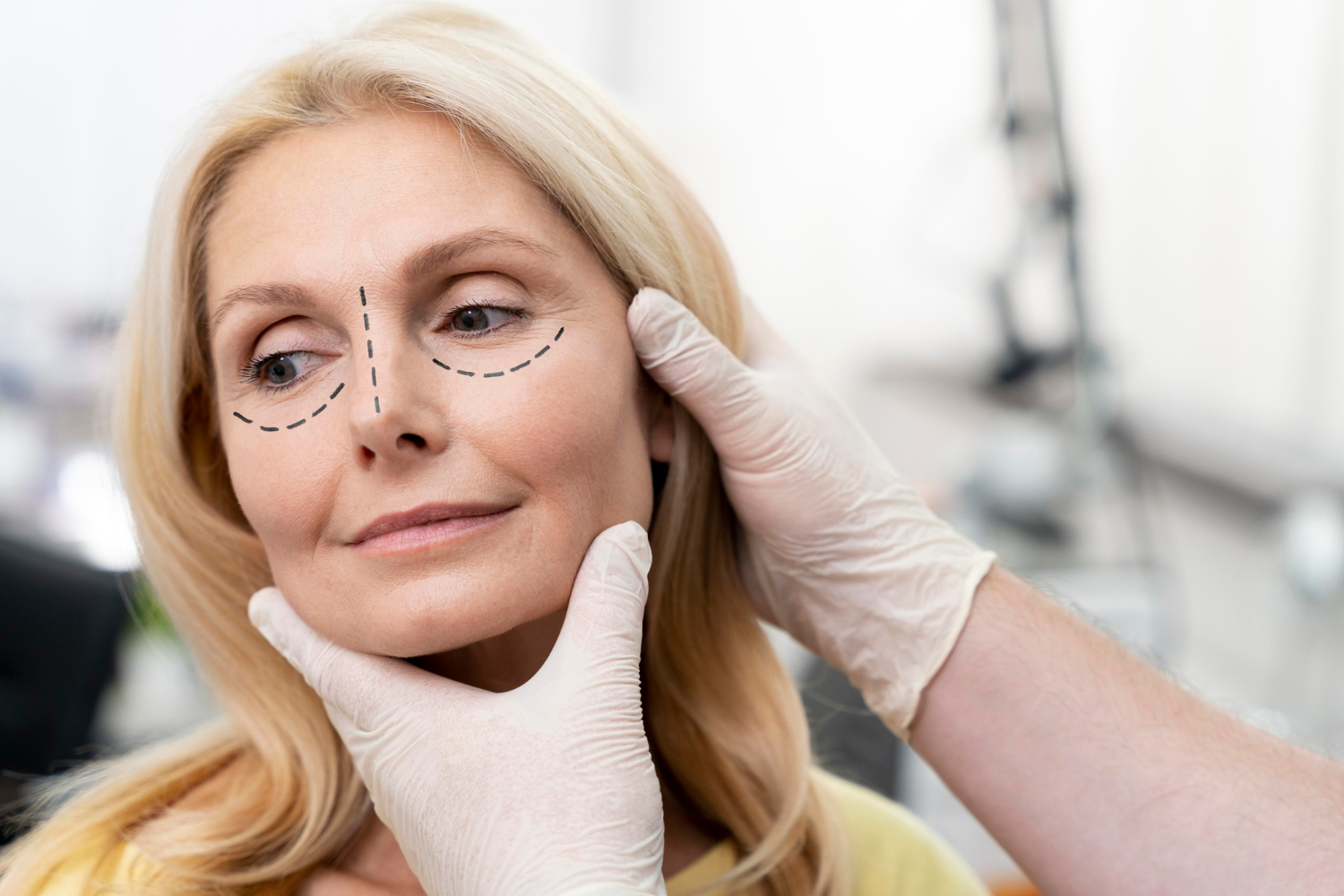 Smart Template Rhinoplasty