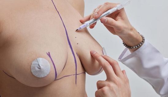 Twirl Internal Bra Technique™