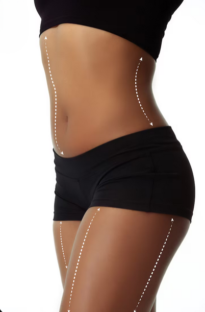 Liposuction