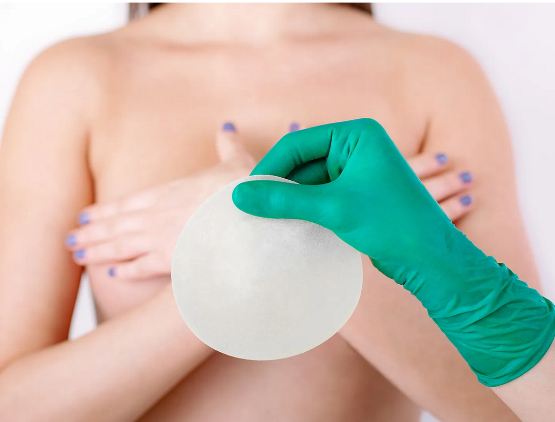 Implant Removal